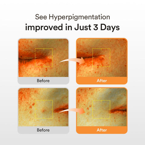 Soonsu Beauty Glutathiosome Dark Spot Serum Vita Drop texture close-up