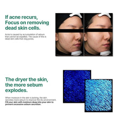 Soonsu Beauty AHA BHA PHA 30 days Miracle Toner side view