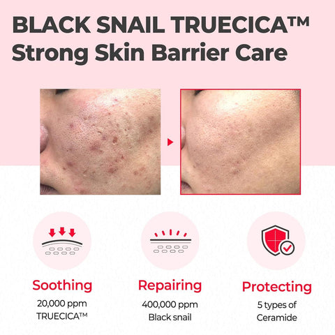 Soonsu Beauty Snail Truecica Miracle Repair Cream front view