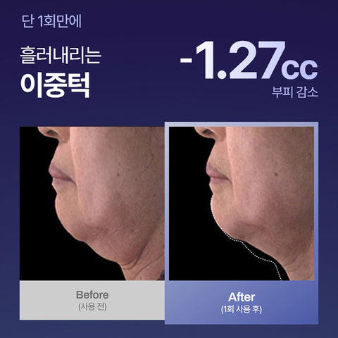 Meditherapy Inmotox Peptide Shot Cream 50ml + Suction Jet Set 2P