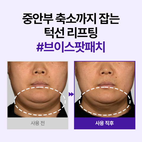 Dermafirm Skin Tension Patch (4 Patches)