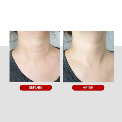 Soonsu Beauty Premium Collagen Naite Thread Neck Cream 2.0 side view