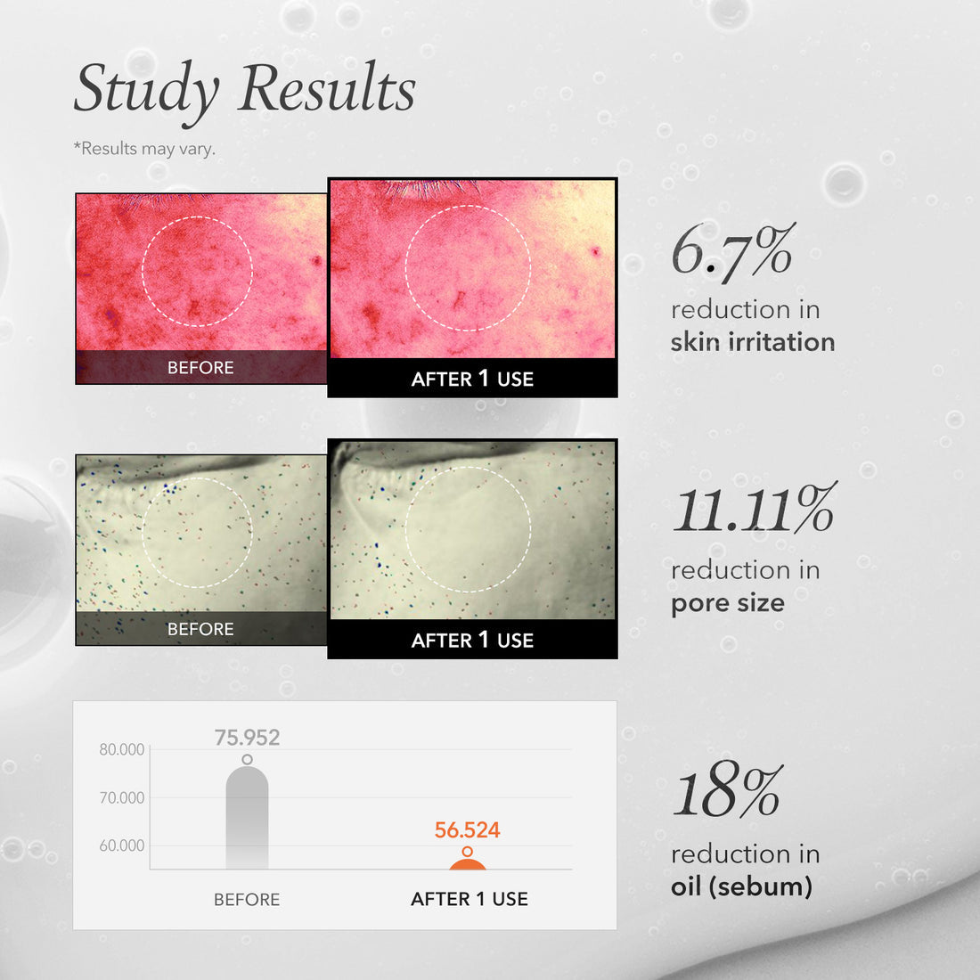 Before and after skin irritation, pore size, and oil reduction study results on a gray background.