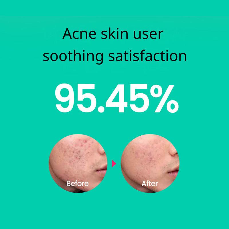 Soonsu Beauty Cicaterol Toner application use