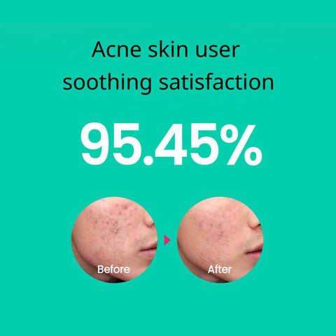 Soonsu Beauty Cicaterol Toner application use