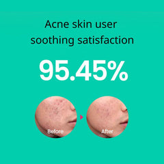 Soonsu Beauty Cicaterol Toner application use