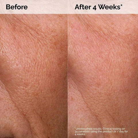 Soonsu Beauty Hyaluronic Acid 2% + B5 texture close-up