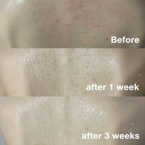 Medicube Red Body Wash 400g