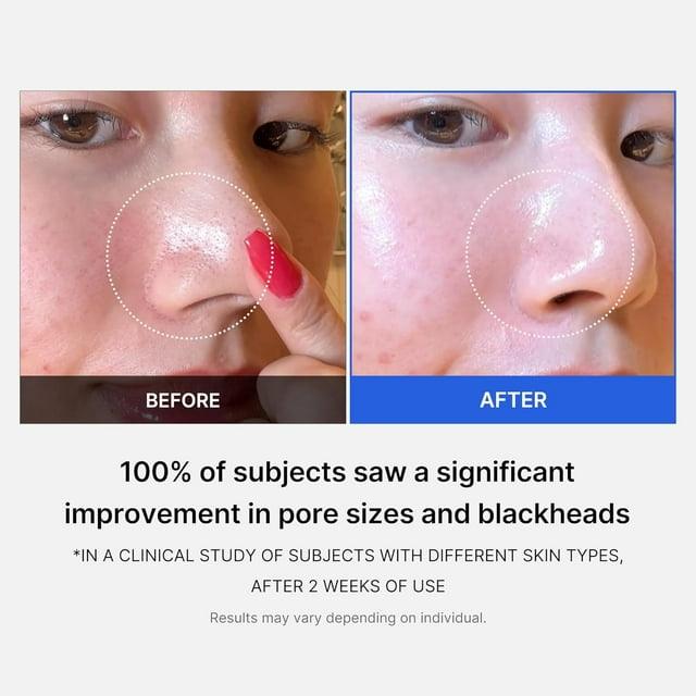 Soonsu Beauty Zero Pore Pad 2.0 packaging design