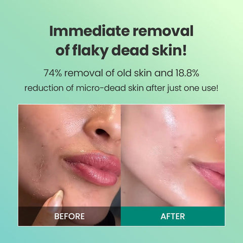 Dr.G Brightening Peeling Gel 120g