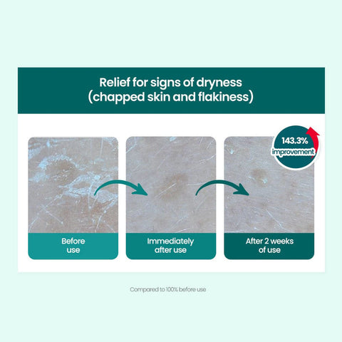 Dr.G R.E.D Blemish Clear Moisture Cream 70ml