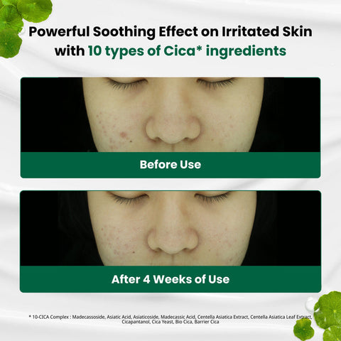 Dr.G R.E.D Blemish Clear Soothing Cream 70ml