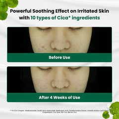 Dr.G R.E.D Blemish Clear Soothing Cream 70ml