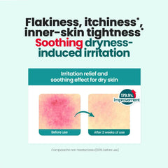 Dr.G R.E.D Blemish Clear Moisture Toner 300ml