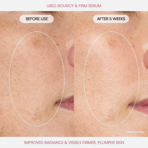 Soonsu Beauty Bouncy & Firm Serum side view